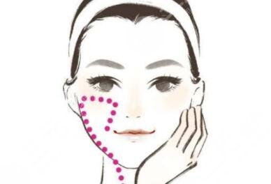 蘋果肌復(fù)位