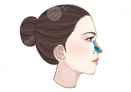 連凱峰隆鼻怎么樣