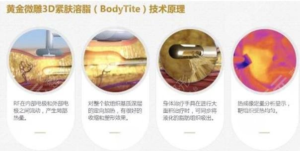 鉆石微雕和黃金微雕區(qū)別