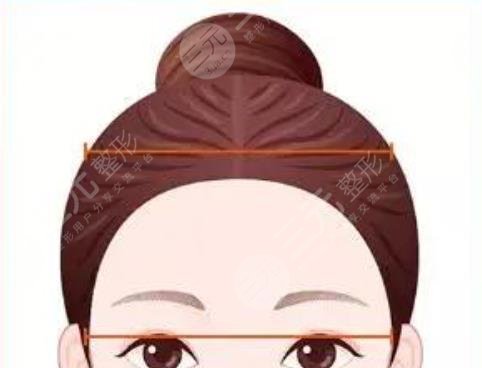 打造高顱頂動(dòng)漫