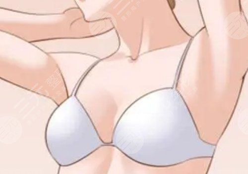 上海汪灝做胸怎么樣？