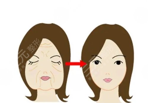 面部輪廓固定需要多少錢？