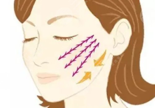 線雕適合多大年齡？