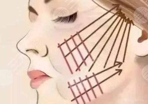 線雕適合多大年齡？