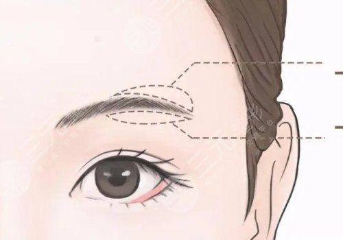 提眉術(shù)多久可以恢復自然？