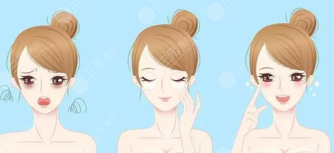 外切眼袋增生鼓包多久消退