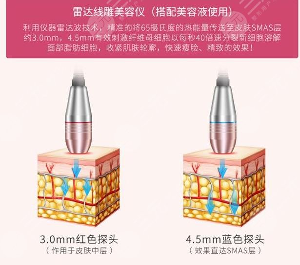 正規(guī)醫(yī)院做線雕多少錢