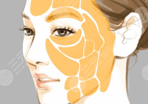 打造幼態(tài)臉需要做多少項目？