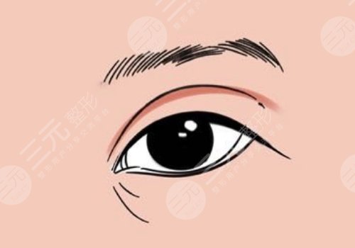 打造幼態(tài)臉需要做多少項目？