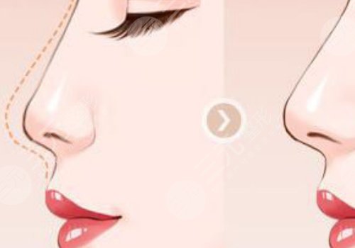 打造幼態(tài)臉需要做多少項目？