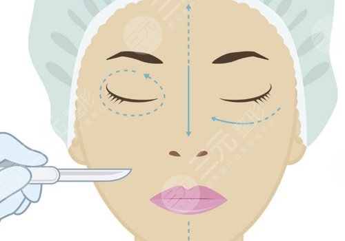 內(nèi)輪廓是指哪里部位？