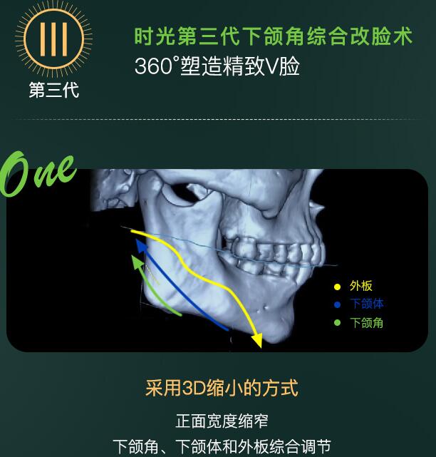 杭州時(shí)光醫(yī)療美容醫(yī)院是三甲嗎，技術(shù)怎么樣？測(cè)評(píng)報(bào)告&價(jià)格一覽！