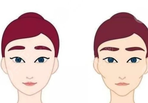 輪廓手術(shù)危險(xiǎn)嗎？