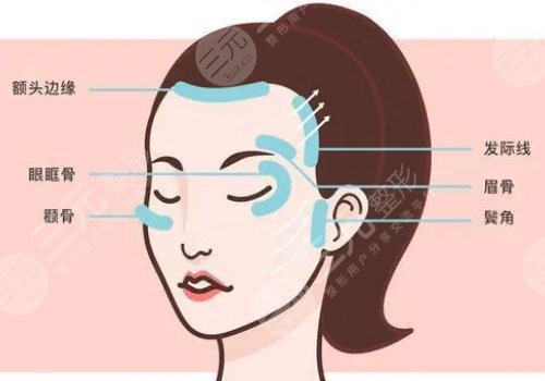 內(nèi)輪廓線和外輪廓線的區(qū)別