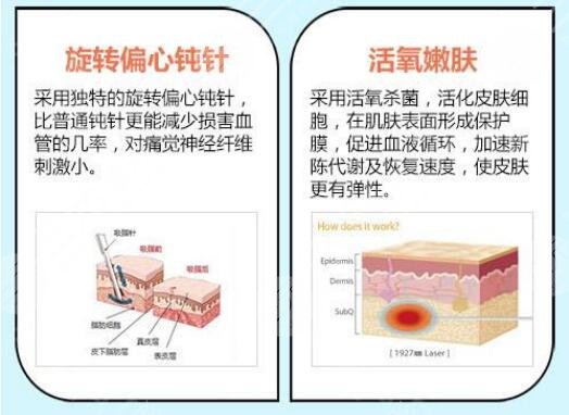 杭州腰腹部吸脂價格公布！好評醫(yī)院2家分享，避坑指南~