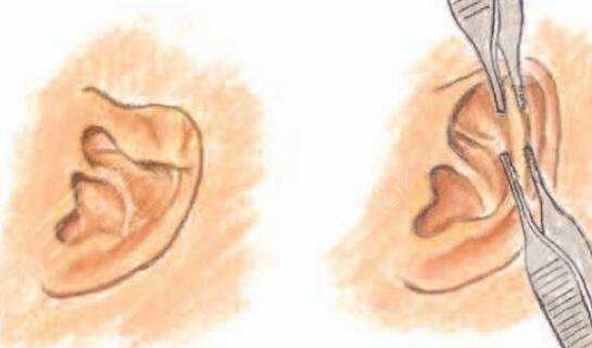 余文林醫(yī)生擅長項目