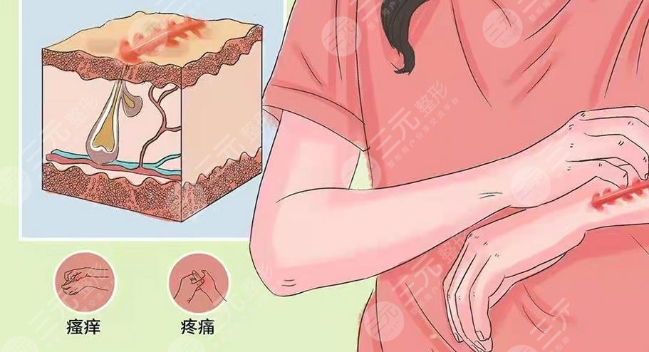 如何祛除臉上的疤痕?