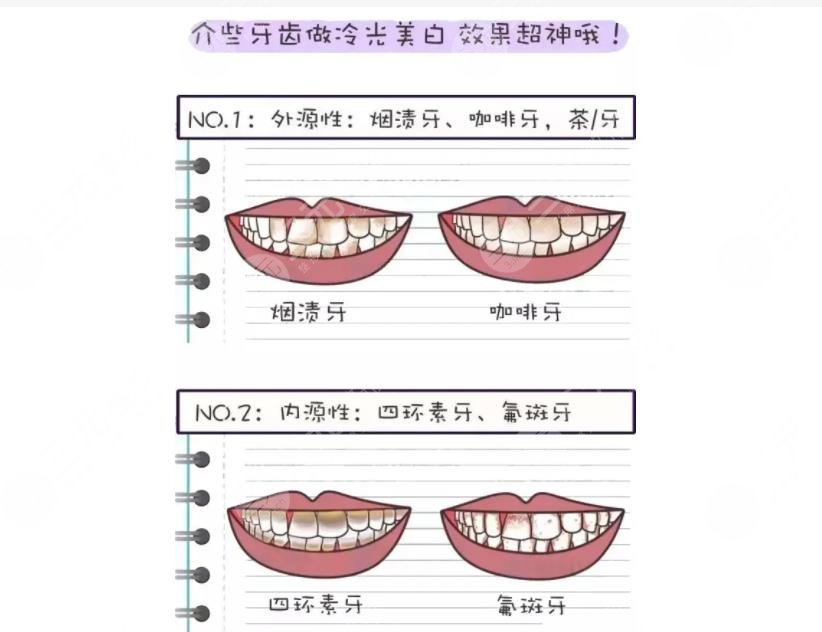 使用小蘇打刷牙有什?么作用?