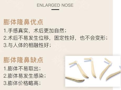 膨體隆鼻恢復(fù)時間多久？科普小課堂！深度了解優(yōu)缺點(diǎn)、價格~
