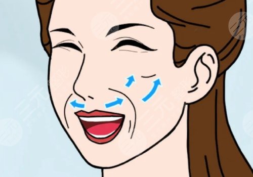 法令紋太深了有什么解決辦法？