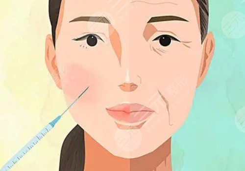 外輪廓固定提升打什么針？