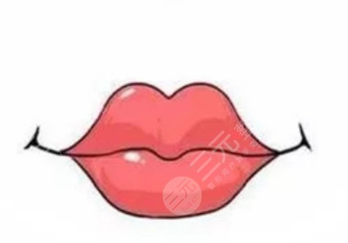 微笑唇打玻尿酸能保持多久？