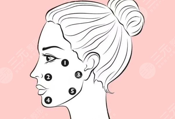 內(nèi)外輪廓固定