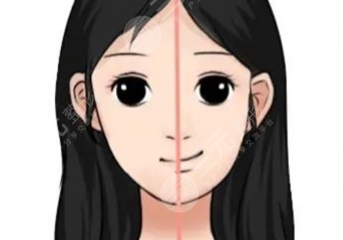 大小臉矯正手術(shù)有風(fēng)險(xiǎn)嗎？