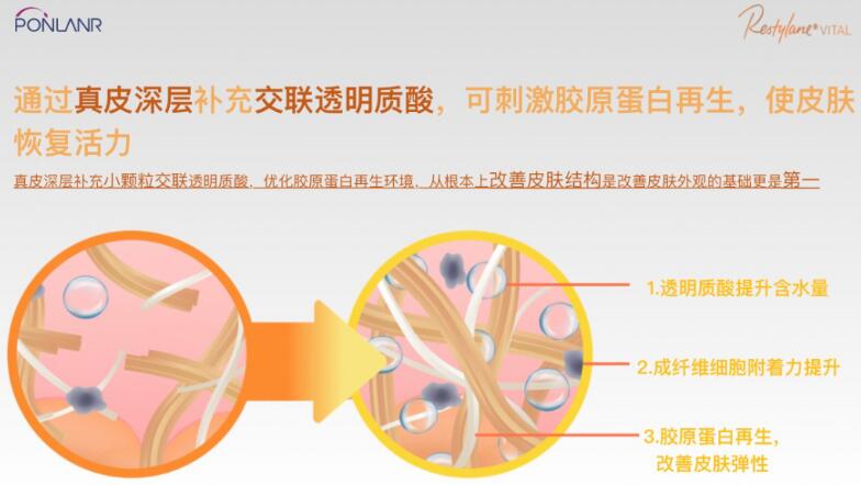 貴婦水光效果怎么樣？高奢維養(yǎng)，美膚指南！