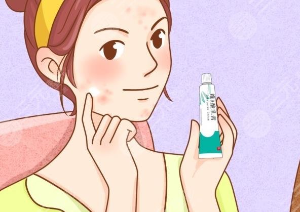 臉頰兩側(cè)長痘痘什么原因