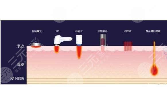 去黑眼圈和眼袋有效的方法是什么？眼周抗衰指南！