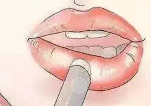 唇部老化的原因有哪些？唇部老化如何改良？