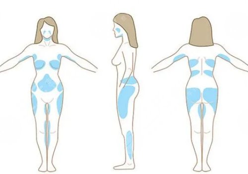 身體塑形能達(dá)到減肥的效果嗎？