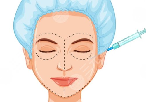 雙美膠原蛋白填充淚溝能維持多久？