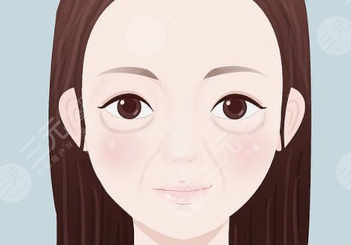 雙美膠原蛋白填充淚溝能維持多久？