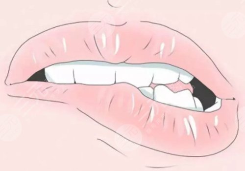 唇部老化的表現(xiàn)有哪些？改良方法有這些！