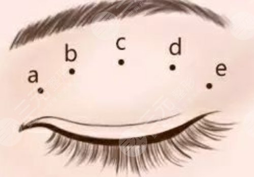 廣州可玉醫(yī)療美容醫(yī)院羅勇怎么樣？