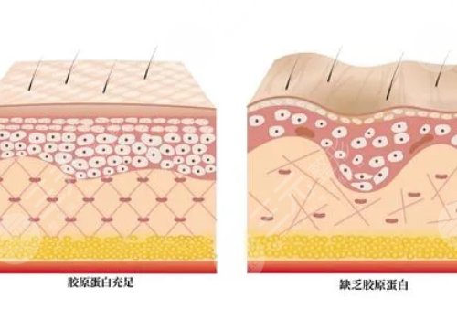 雙美膠原蛋白有幾種型號(hào)？