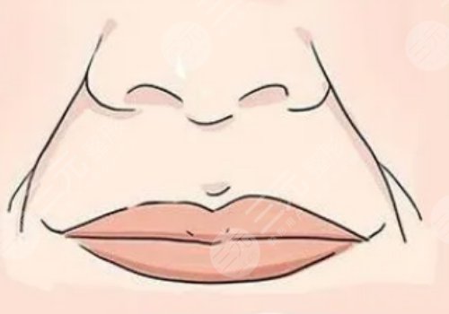 括號紋怎么去掉？怎么形成的？改良方式解讀！