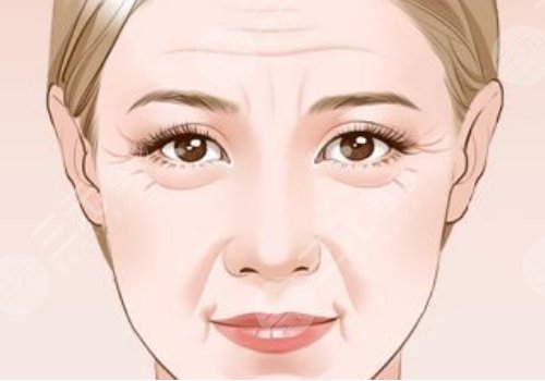 括號紋怎么去掉？怎么形成的？改良方式解讀！