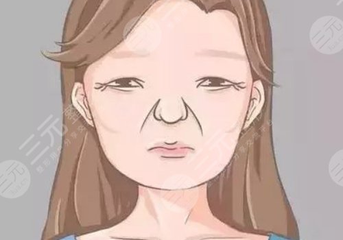 括號紋怎么去掉？怎么形成的？改良方式解讀！