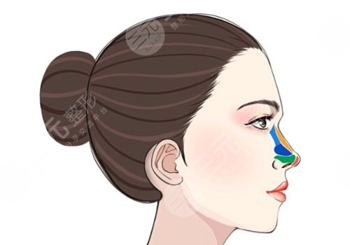 廣州市荔灣區(qū)人民醫(yī)院整形美容隆鼻怎么樣？