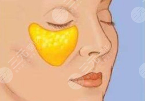 眼窩凹陷用什么填充好？