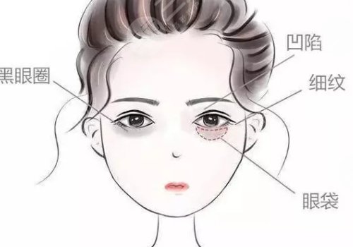 眼窩凹陷用什么填充好？