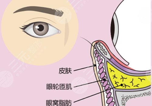眼窩凹陷用什么填充好？