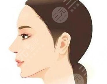 改良臉部輪廓做什么整形