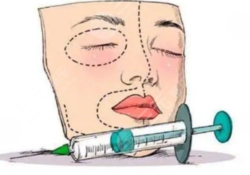 玻尿酸填充下巴有什么副作用？