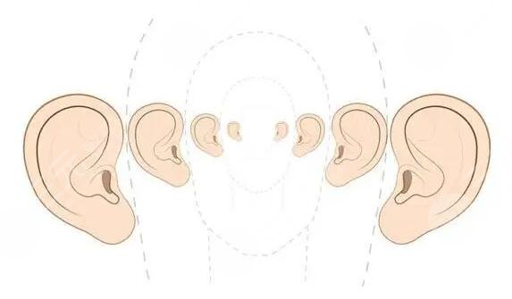 耳朵矯正