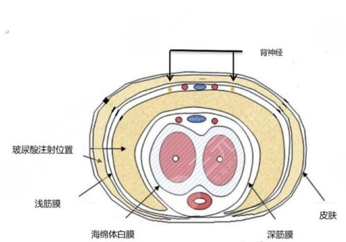 玻尿酸男性增大注射要多少錢？