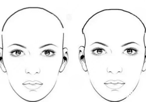 假體填充太陽凹大概多少錢？